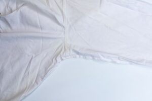 Manchas amarillas en la ropa blanca