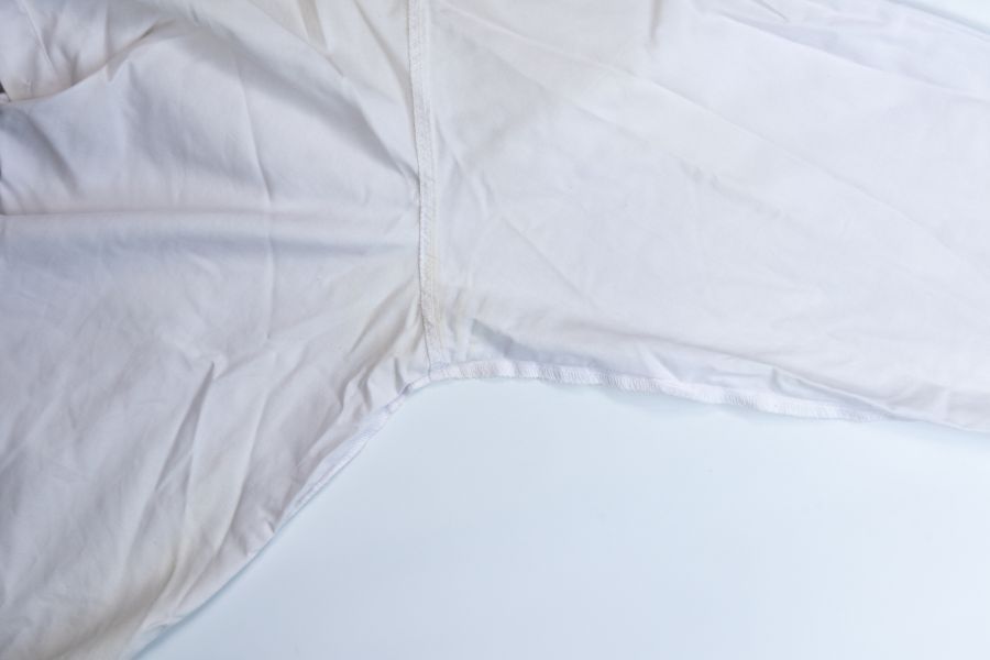 Manchas amarillas en la ropa blanca